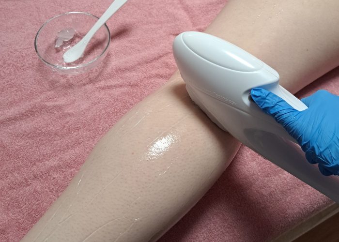 Séance d’épilation à la lumière pulsée chez Sun Modelage, institut de beauté à Wormhout dans le Nord